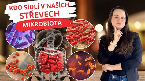 Schéma faktorov ovplyvňujúcich vaginálnu mikroflóru