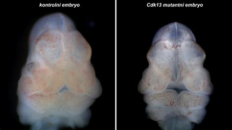 Ilustrácia embrya s vyvíjajúcou sa neurálnou trubicou