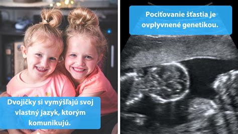 Ilustrácia jednovaječných a dvojvaječných dvojčiat
