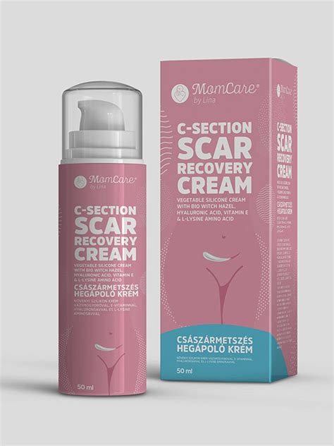 Ilustrácia jazvy na maternici po cisárskom reze