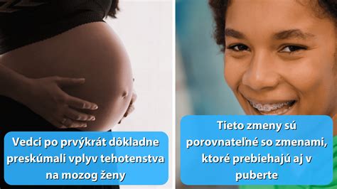 Fyzické zmeny ženy počas tehotenstva