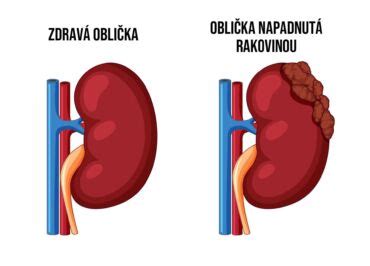 štruktúra obličky