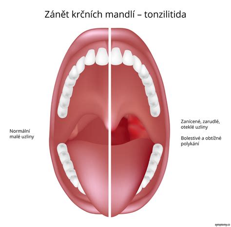 Anatomia nosohltana a krčných mandlí