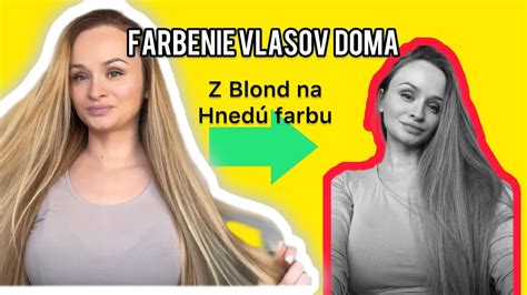 Infografika zobrazujúca gény zodpovedné za farbu vlasov a očí