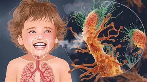 ilustrácia dieťaťa s vlhkým kašľom a hlienom