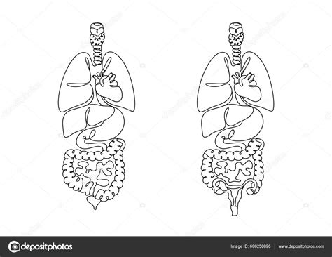 Anatomická kresba mieška s hydrokélou