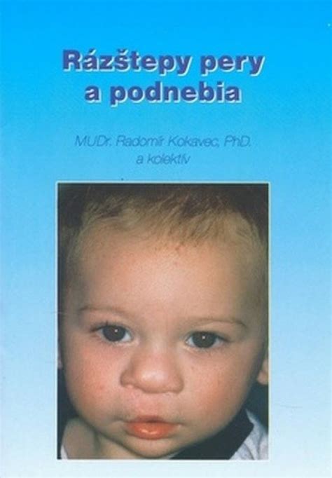 Ilustrácia rázštepu pery a podnebia