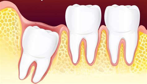 Ilustrácia tehotnej ženy s bolesťou zuba