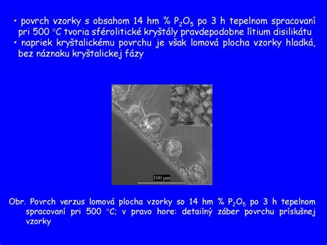 Schéma diagnostických metód pri myómoch