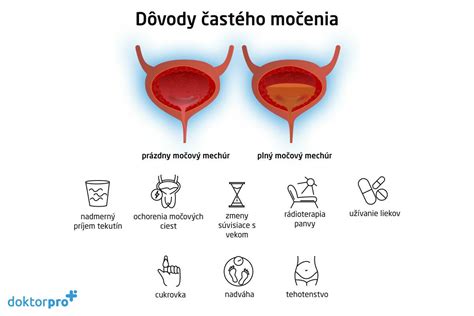 Infografika o príčinách častého močenia