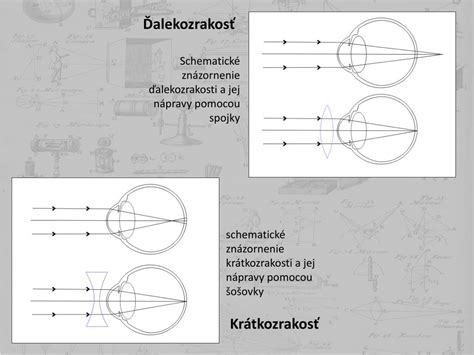 Schematické znázornenie ďalekozrakosti a krátkozrakosti