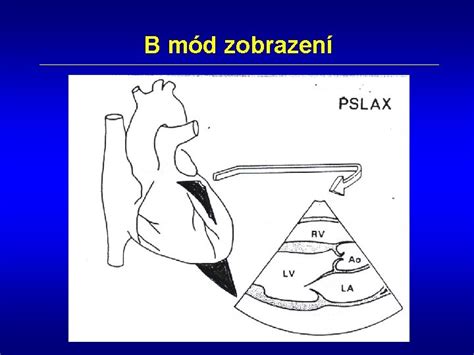 Ilustrácia rôznych ultrazvukových zobrazení: A-mód, B-mód, M-mód