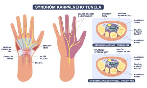 Infografika zobrazujúca vrstvy materiálu rukávnika