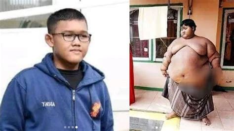 Arya Permana pred a po schudnutí