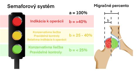 Schéma ultrazvukového vyšetrenia bedrových kĺbov