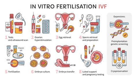 schéma IVF