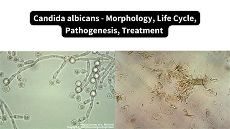 Mapa šírenia Candida albicans