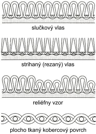 Schematické znázornenie rôznych stupňov placenty accreta
