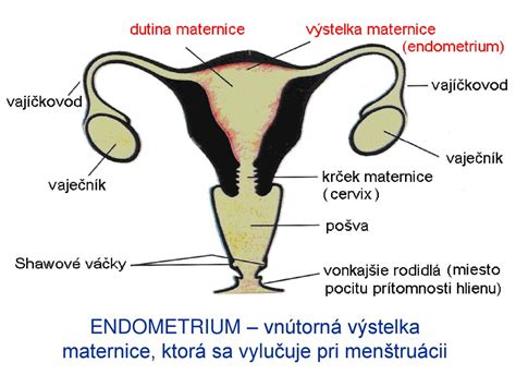 Schéma kyretáže maternice