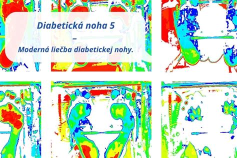 Grafika zobrazujúca rôzne metódy liečby ADHD