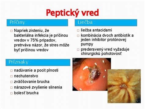bakteriálna infekcia čreva