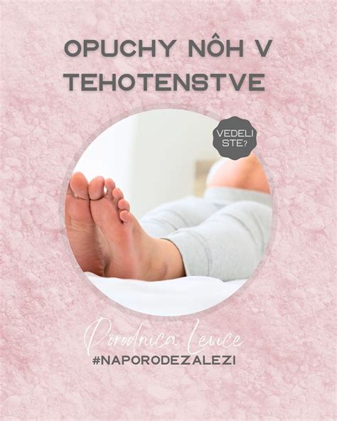 Tabuľka s odporúčanými cvikmi a tipmi na zmiernenie opuchov nôh