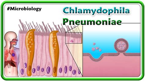 Ilustrácia baktérie Chlamydophila pneumoniae