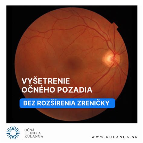 Ilustrácia vnútra oka a očného pozadia