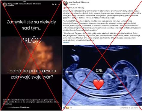 Zobrazenie vnútorných orgánov na ultrazvuku