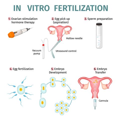 Schéma procesu IVF (In Vitro Fertilization)