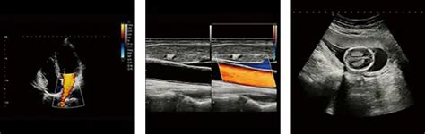 Obraz z ultrazvukového vyšetrenia panvových orgánov