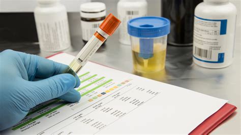 Graf zobrazenie percentuálneho zastúpenia baktérií spôsobujúcich infekcie močových ciest