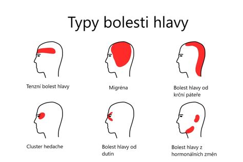 Infografika varovných príznakov po úraze hlavy u dieťaťa