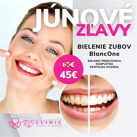 Infografika zobrazujúca rôzne prírodné metódy bielenia zubov