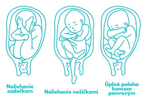 Schéma polôh plodu v maternici