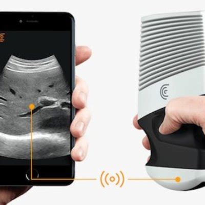 Ultrazvukové zariadenie zobrazujúce nohu