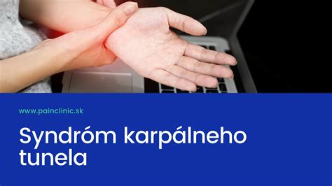 Graf výskytu syndrómu karpálneho tunela v tehotenstve