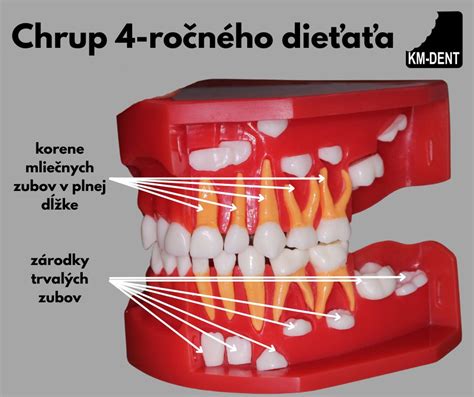 Infografika: Vývoj chrupu a vplyv cumlíka