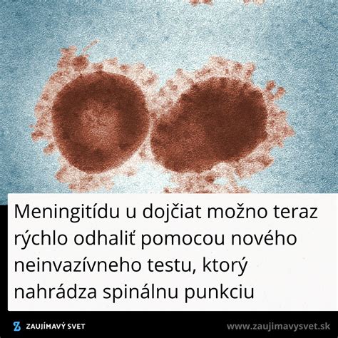 Ilustrácia príznakov meningitídy u dojčiat