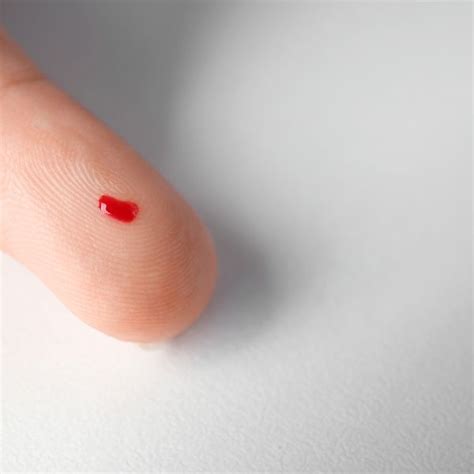 Ilustrácia odberu kvapky krvi z päty novorodenca