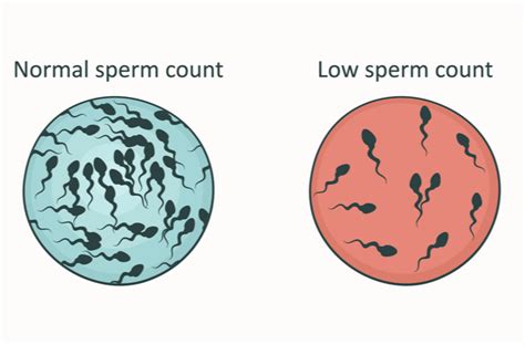 Infografika zobrazujúca možné príčiny neplodnosti u mužov a žien