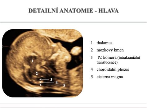 Ultrazvukové meranie plodu