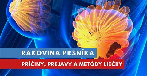 Schéma ukazujúca príznaky zápalu prsníka