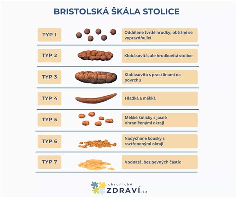 farebná škála stolice novorodenca