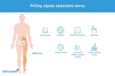 mapa sedacieho nervu