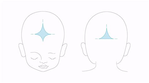 Ilustrácia vypuklej fontanely