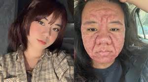 Žena pláva v bazéne počas tehotenstva