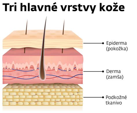 štruktúra kože pri atopickom ekzéme