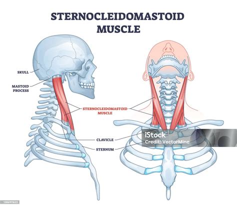 Ilustrácia svalu kývača hlavy (m. sternocleidomastoideus)