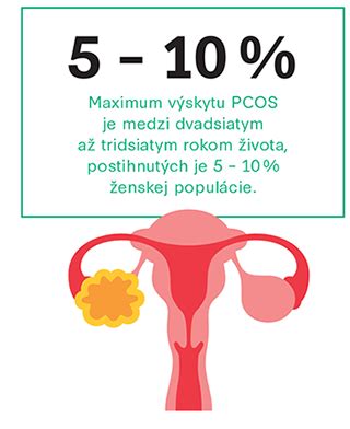 infografika o syndróme polycystických ovárií